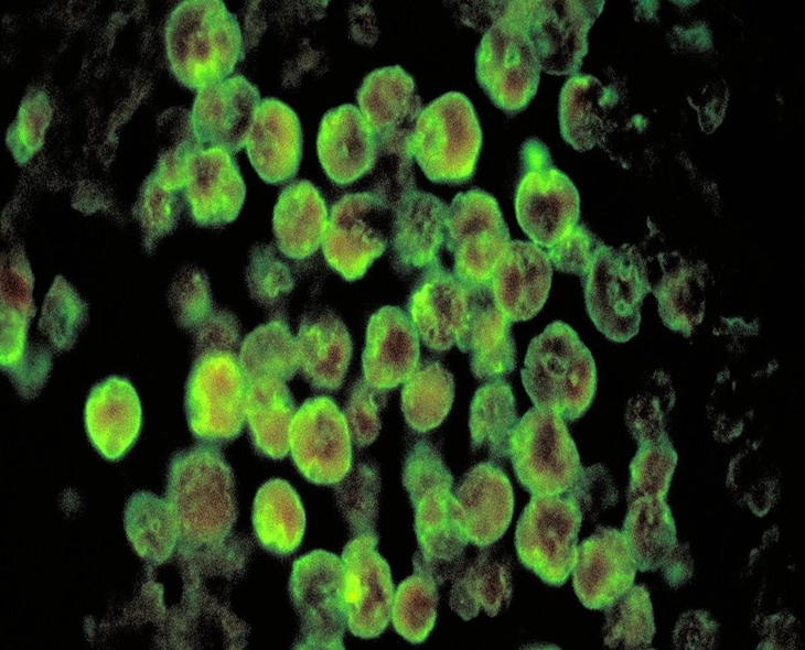 Two People Died From Amoebic Meningoencephalitis In Kerala