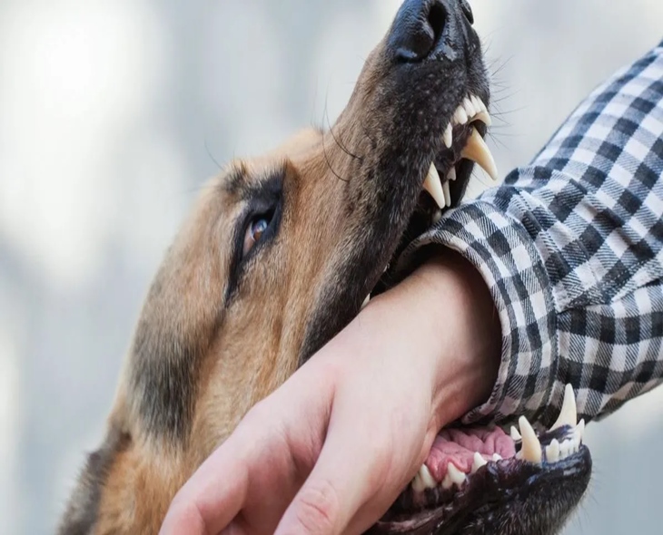 Vital First Aid Steps After A Dog Bite