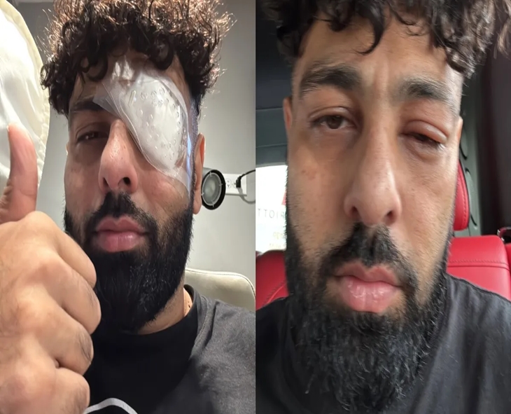 Badshah Suffers Eye Injury During Tour, Shares Recovery Update