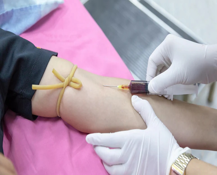 New Blood Test Detects Head And Neck Cancer Up To 10 Years Early