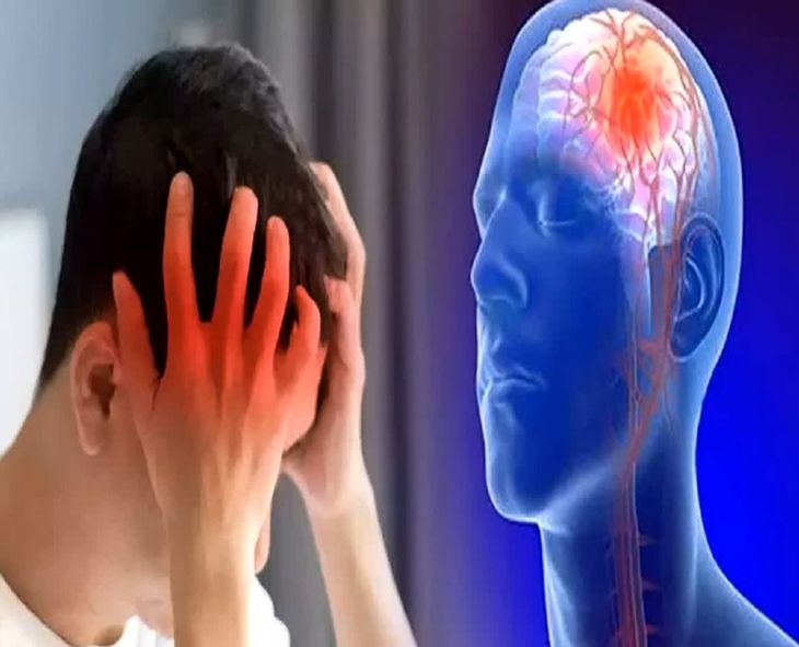 Brain Strokes In Youth: A Wake-Up Call For A Healthier Life