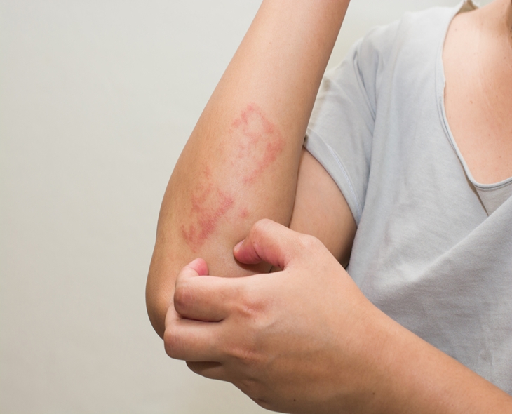TIP! Probiotics May Reduce Allergy Symptoms