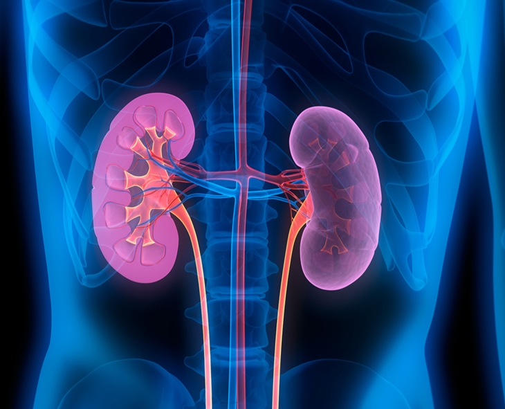 Do All Kidney Stones Need Surgery? Expert Explains