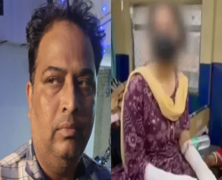 Delhi Man Burns Daughter’s Hands To Fake Acid Attack, Cover Up Rape Case