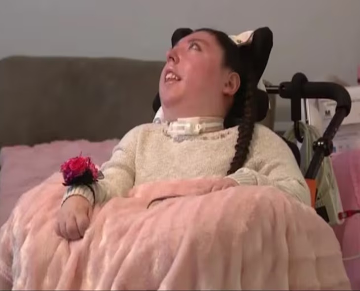 US Woman Born Without Brain Defies Odds, Celebrates 20th Birthday