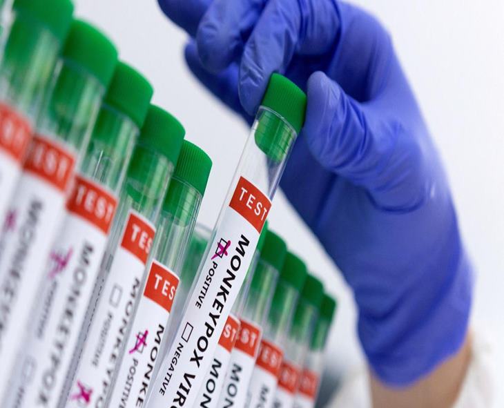 Oct Sees 2,501 Mpox Cases, 12 Fatalities Worldwide: WHO