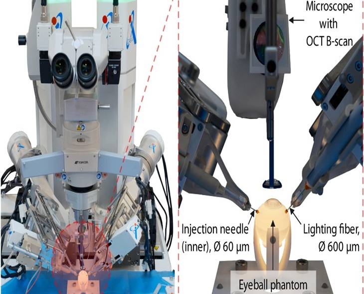 Chinese Robot Performs Precise Eye Surgery Autonomously