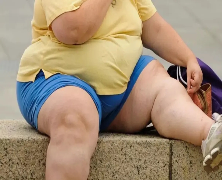 Obesity Linked To Rising Cancer Risk