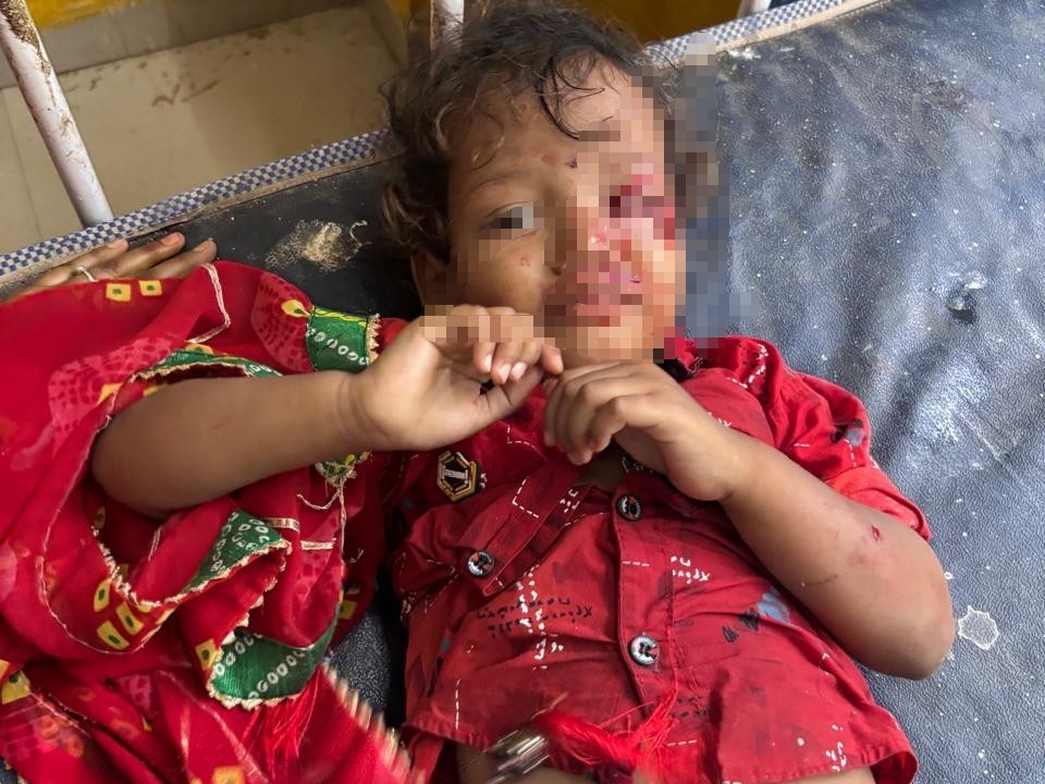 కుక్కల దాడిలో పలువురికి గాయాలు