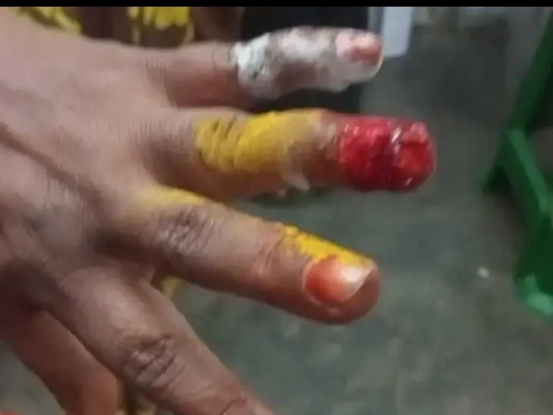 సమీప మహిళపై దాడికి పాల్పడిన బంధువు