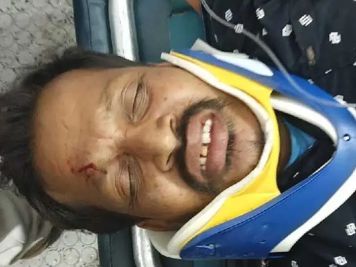 రోడ్డు ప్రమాదంలో వ్యక్తికి తీవ్రగాయాలు