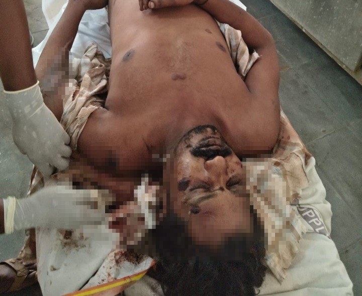 కంకిపాడు – గుడివాడ రోడ్డులో గోతిలో పడి వ్యక్తి మృతి