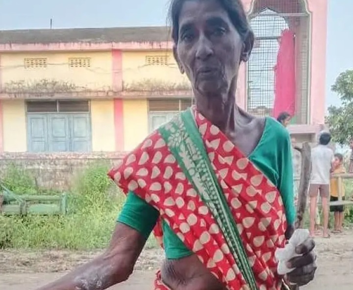 కోతుల దాడిలో మహిళకు గాయాలు