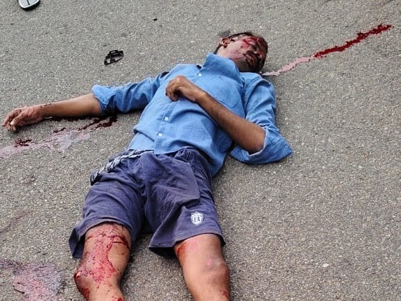 ఆరిలోవలో రోడ్డు ప్రమాదం.. ఇద్దరికి గాయాలు