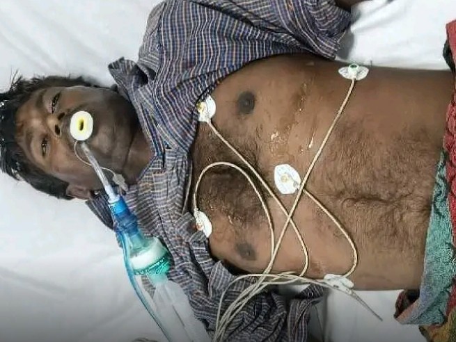 వాహనంపై నుంచి పడి వ్యక్తి మృతి