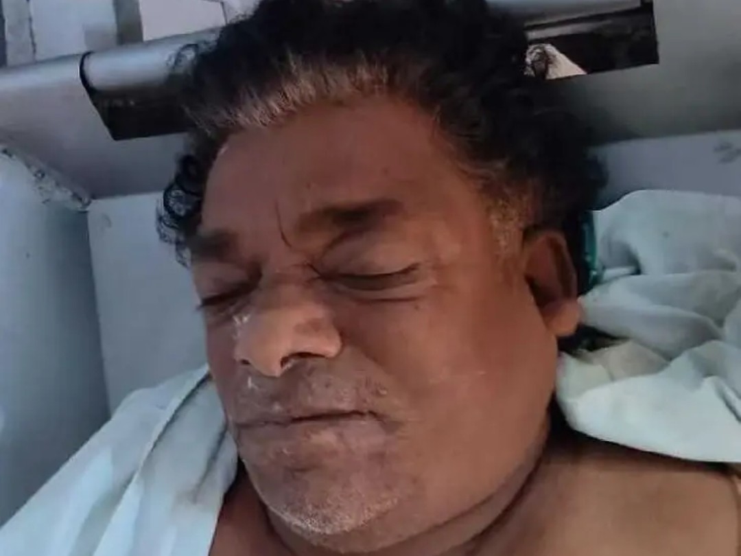 తిరుపతిలో గుర్తుతెలియని వ్యక్తి మృతి