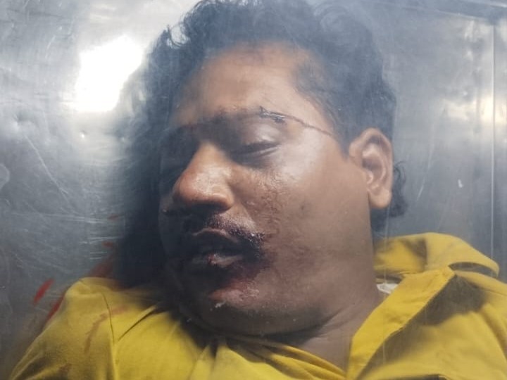 పుత్తూరులో రోడ్డు ప్రమాదం.. ఒకరి స్పాట్ డెడ్