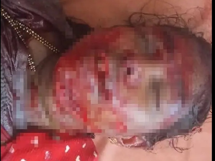 భార్య కాపురానికి రాలేదని కత్తితో దాడి