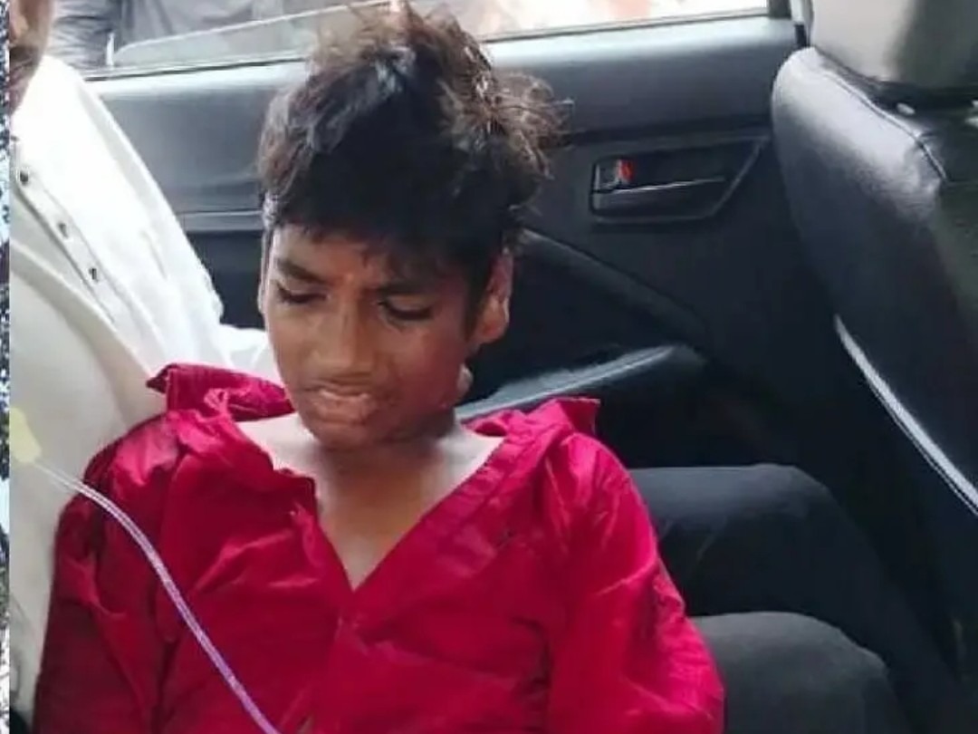 చెట్టు కొమ్మ తలపై పడడంతో విద్యార్థికి గాయాలు