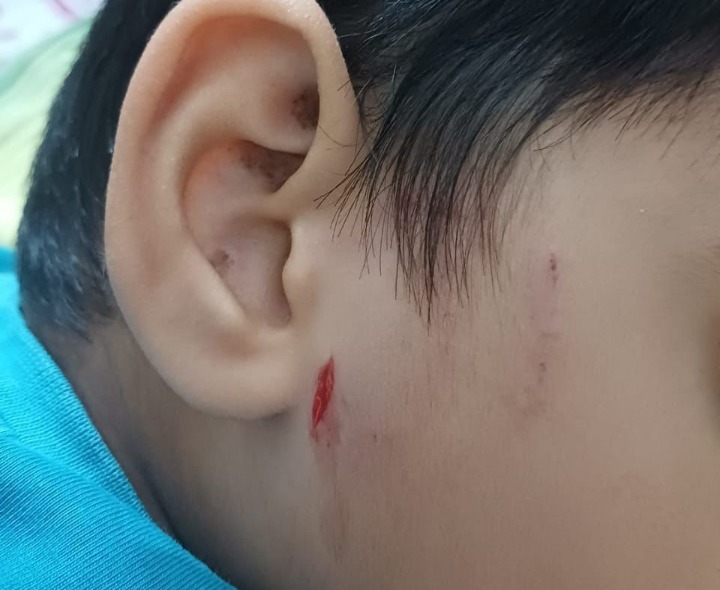 గుడివాడలో బాలుడిపై కుక్కల దాడి