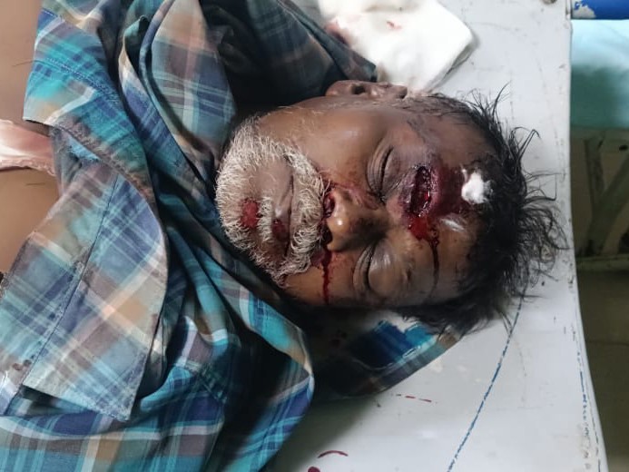 రోడ్డు ప్రమాదంలో గాయపడిన వ్యక్తి.. మృతి