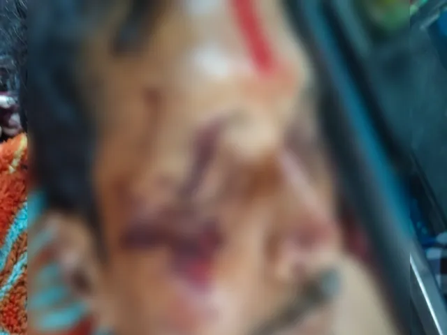 సంబేపల్లి ట్రాక్టర్ ప్రమాదంలో.. రైతు మృతి