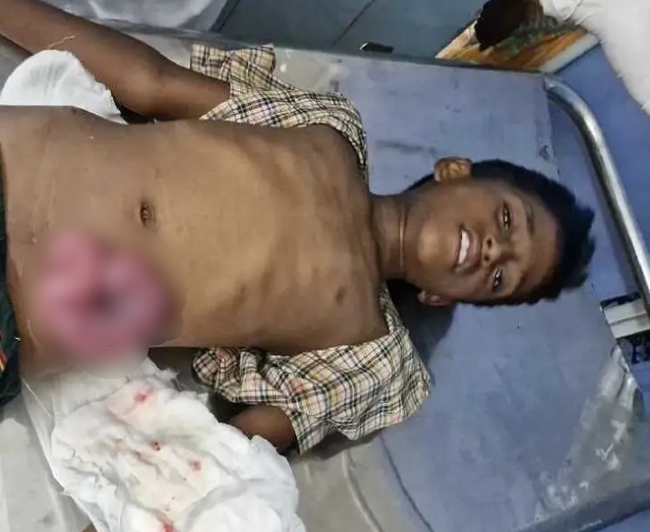 బాత్రూంలో పడ్డ విద్యార్థికి తీవ్ర గాయం