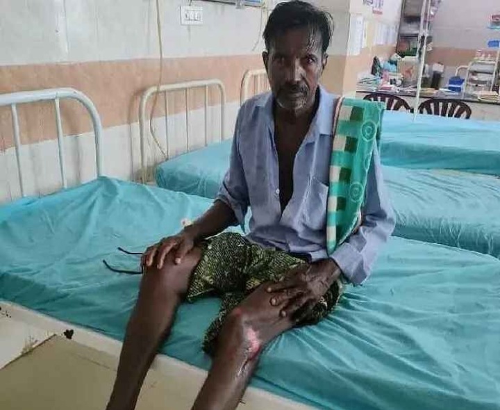 ద్విచక్ర వాహనంపై ప్రయాణిస్తున్న వ్యక్తిపై కుక్కల దాడి