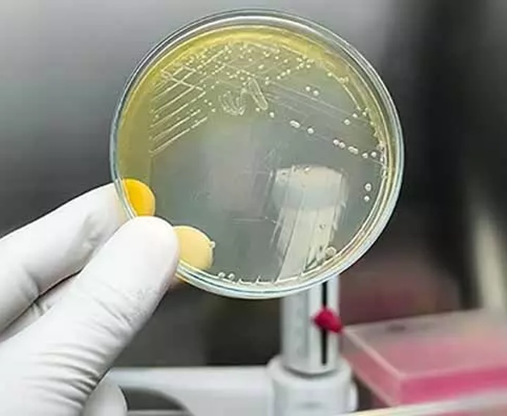 ఏపీలో మరో మెలియాయిడోసిస్ కేసు నమోదు