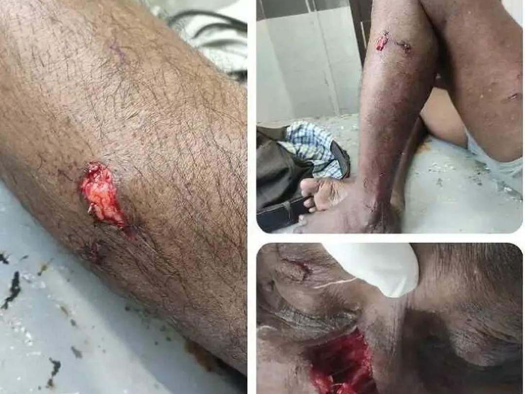 కుక్కల దాడిలో పలువురికి గాయాలు