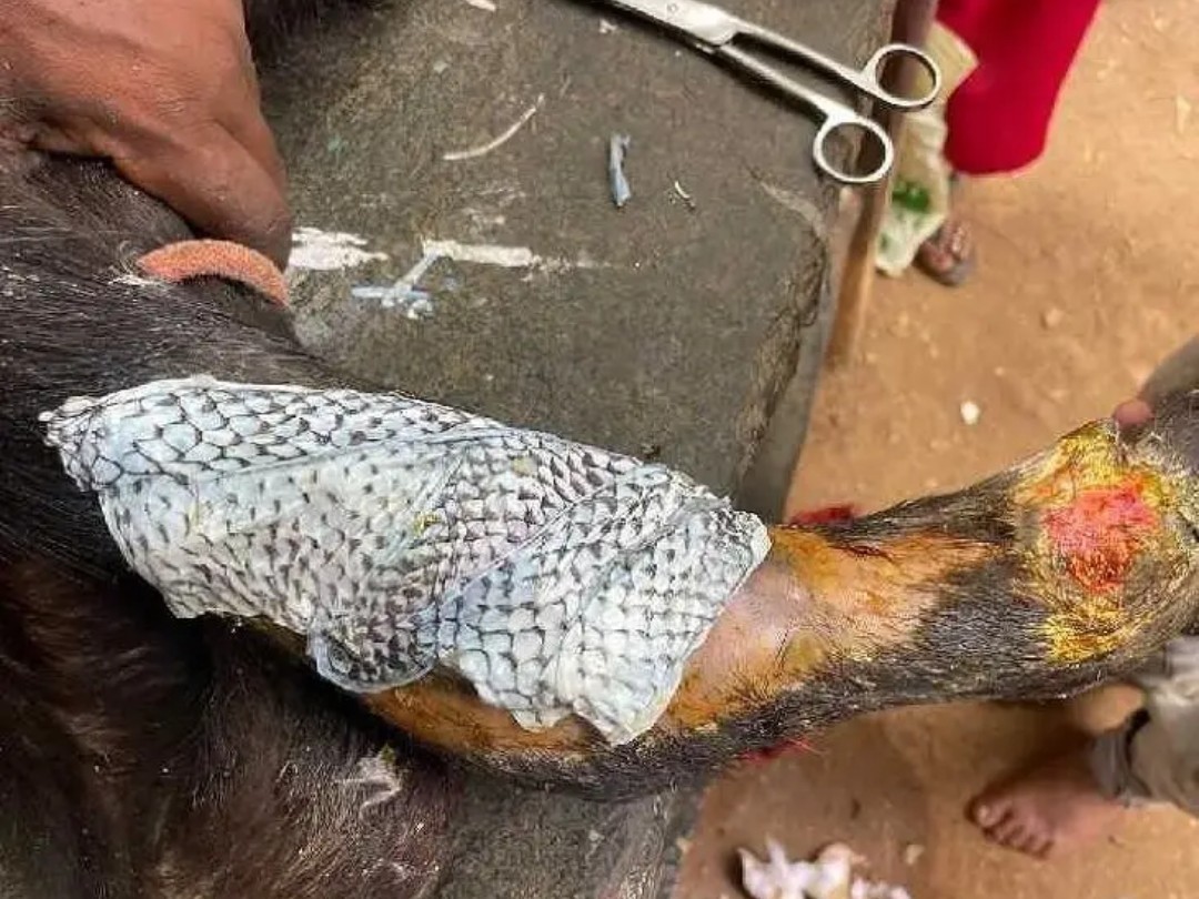 చేప చర్మంతో అరుదైన శస్త్ర చికిత్స