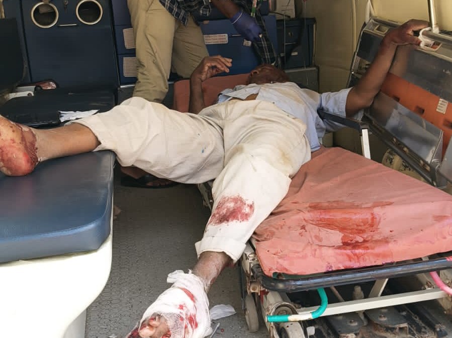 బైక్ ను ఢీ కొట్టిన ఆర్టీసీ బస్సు.. వ్యక్తికి తీవ్రగాయాలు