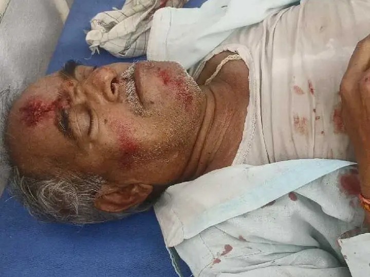 బీసీ బంద్‌లో అపశృతి