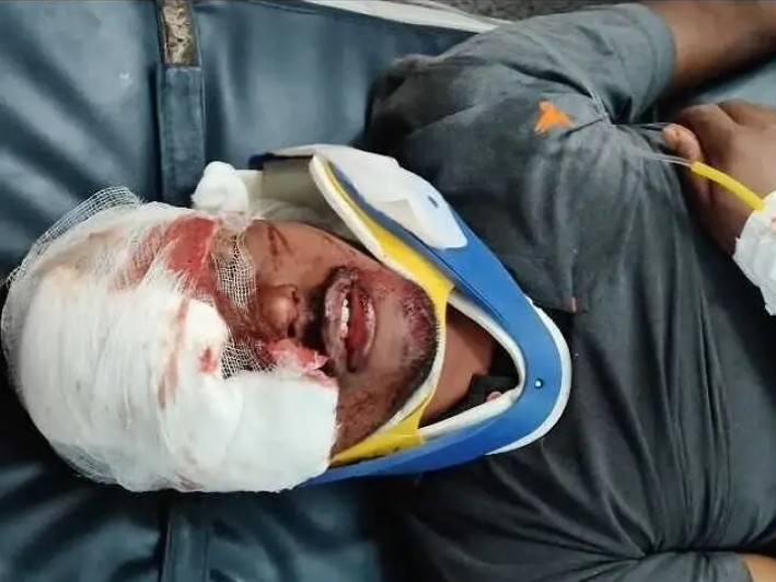 రోడ్డు ప్రమాదంలో ఇద్దరు యువకులకు తీవ్ర గాయాలు