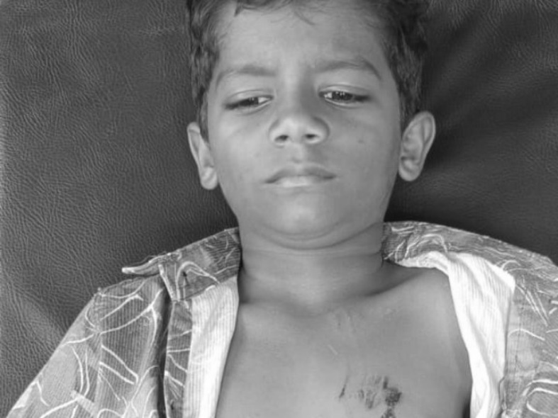 వీధికుక్క దాడి… బాలుడికి గాయాలు