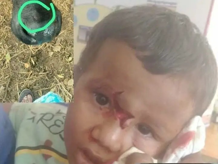 మూడేళ్ల బాలున్ని కరిచిన కుక్క