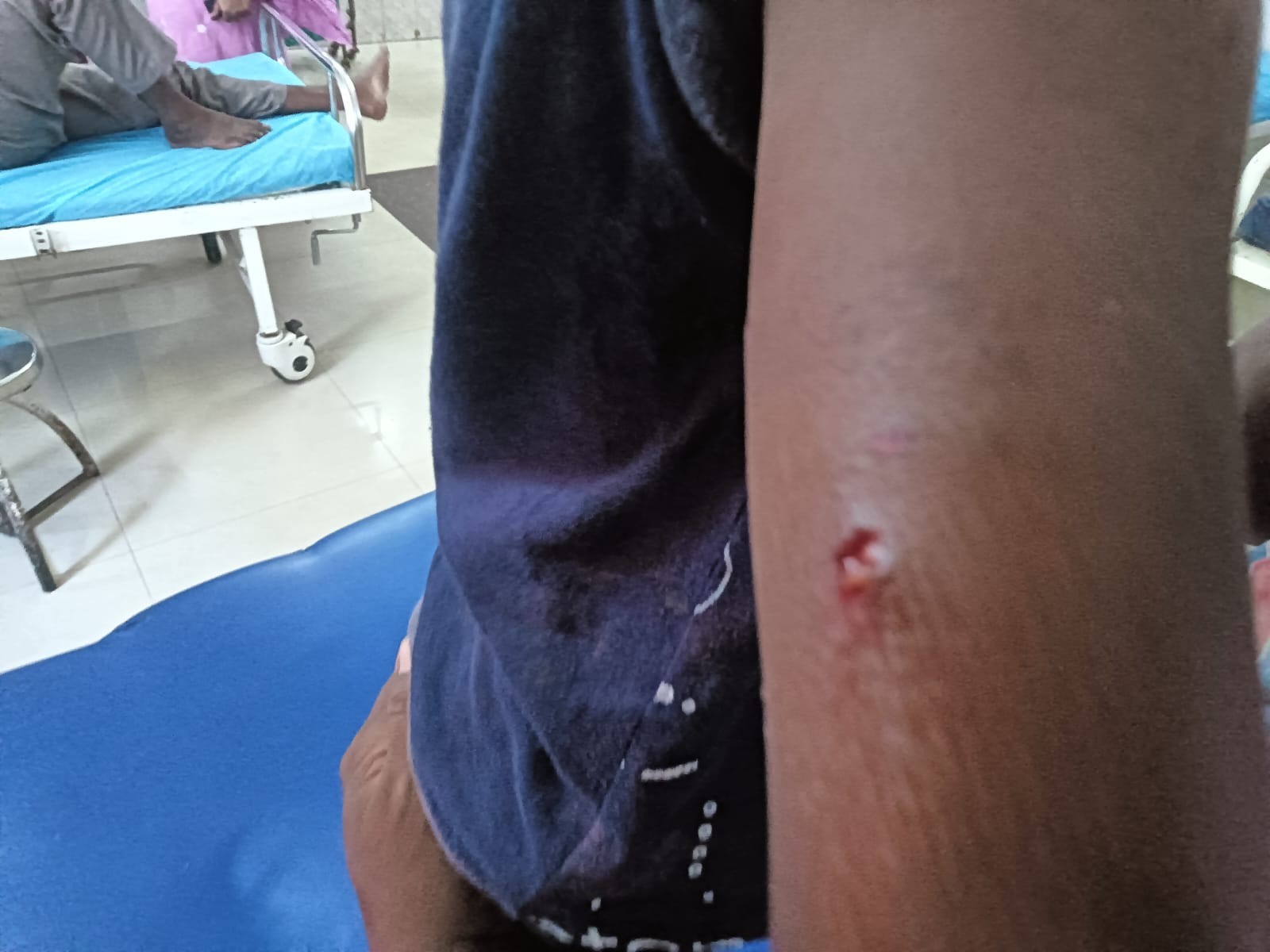 బాలుడిపై వీధి కుక్కల దాడి