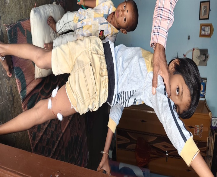పిచ్చికుక్కల దాడి.. చిన్నారులకు గాయాలు