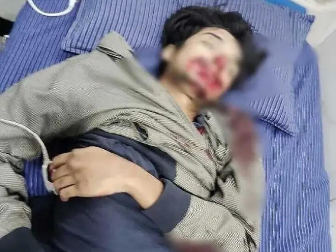 డివైడర్‌ను ఢీకొని యువకుడు మృతి