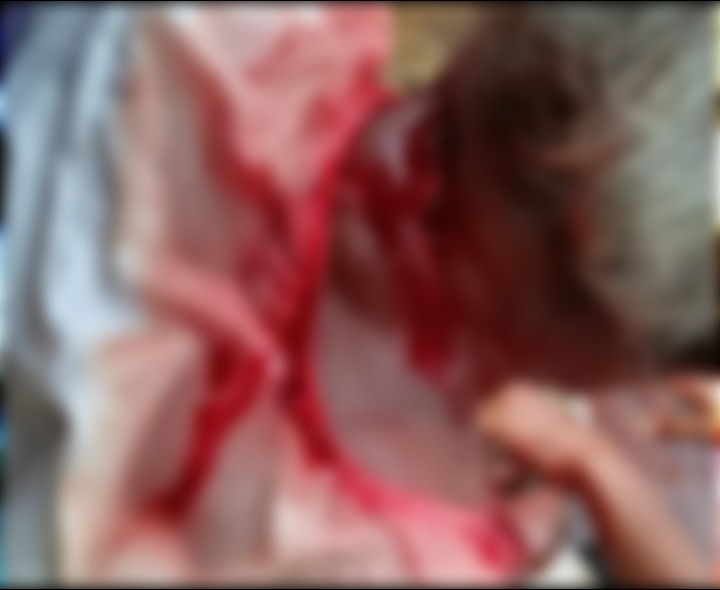 వృద్ధుడిపై గొడ్డలితో దాడి