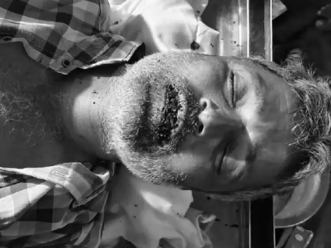 కొబ్బరి చెట్టుపై నుంచి పడి వ్యక్తి మృతి