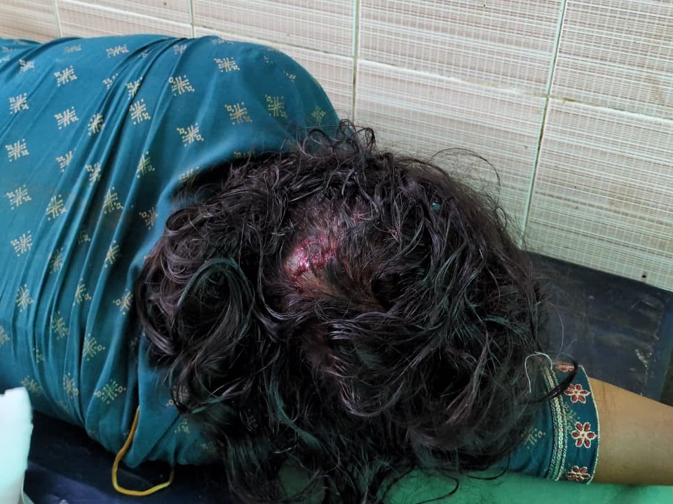 రైలు దిగుతుండగా ప్రమాదవశాత్తు తలకు గాయం