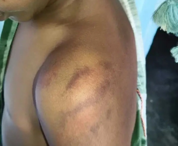 విద్యార్థిని చితకబాదిన ఉపాధ్యాయుడు