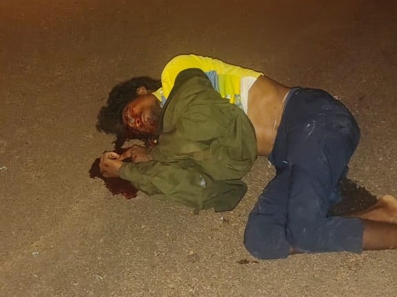 జైపూర్ జంక్షన్ వద్ద ప్రమాదం.. ఒకరికి తీవ్ర గాయాలు