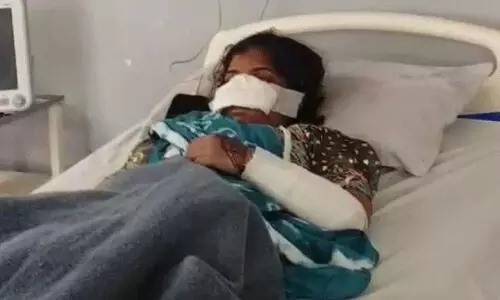 భార్య ముక్కు కోసిన భర్త