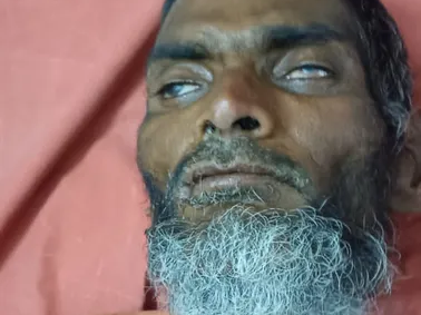 రాయచోటి ఆసుపత్రిలో  గుర్తుతెలియని వ్యక్తి చికిత్స