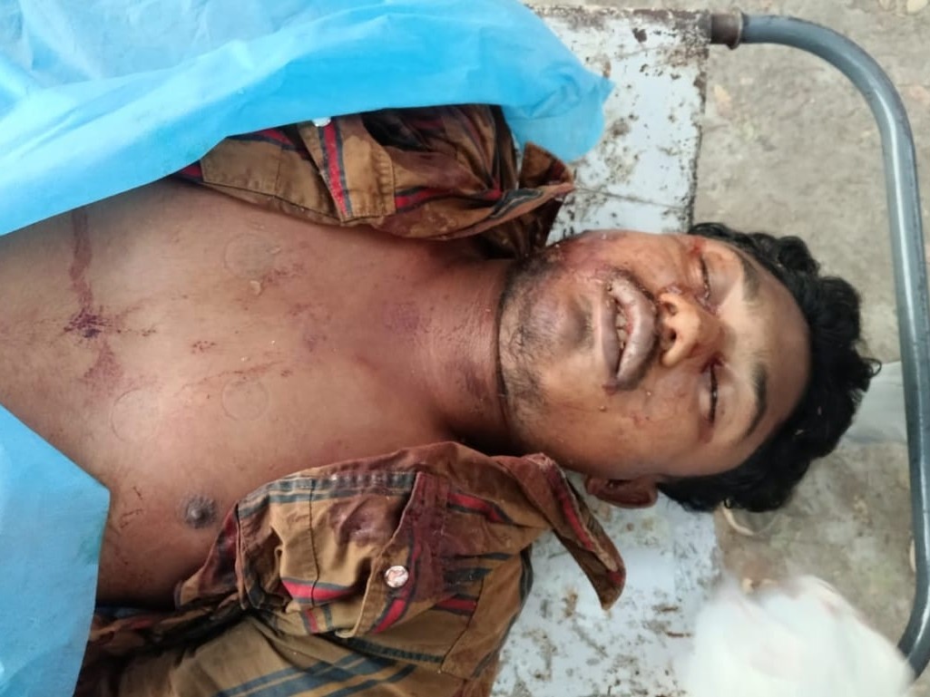 UPDATE: అంకోలిలో రోడ్డు ప్రమాదం.. యువకుడు మృతి