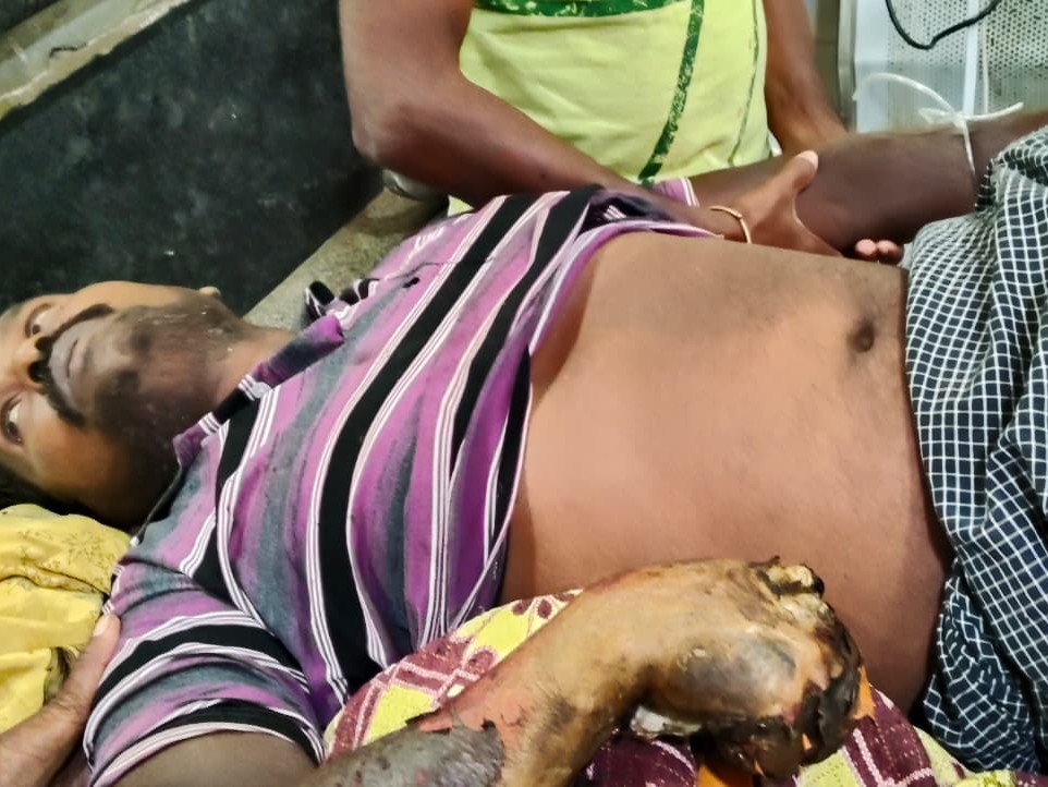 ప్రమాదవశాత్తు విద్యుత్ షాక్ కు గురైన రైతుకు గాయాలు