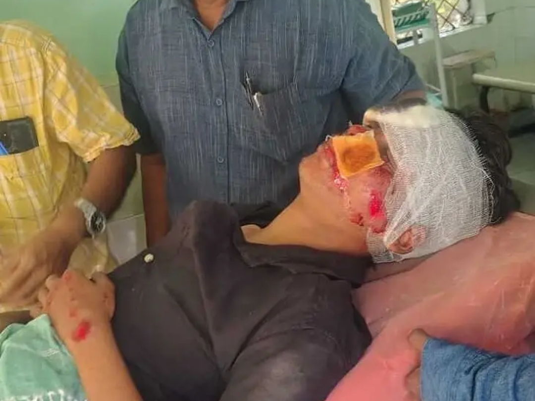 రోడ్డు ప్రమాదంలో యువకుడికి తీవ్రగాయాలు