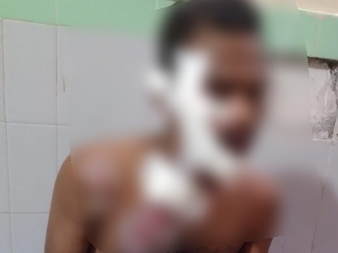 ఆటో బోల్తా యువకుడికి గాయాలు